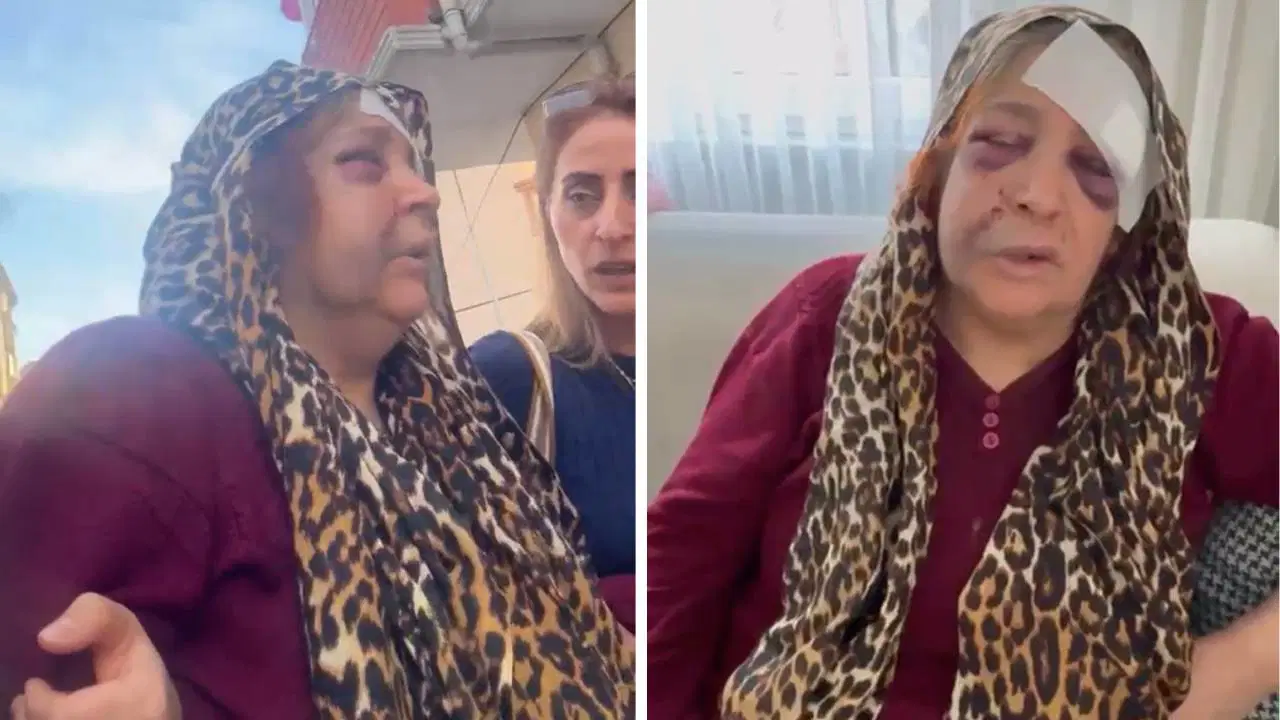 Kızını silahla vuran damadını öldüren kayınvalideyi mahalleli karşıladı