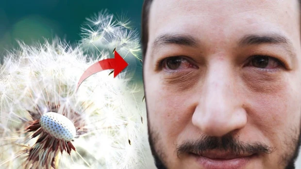 Sadece dışarıda değil evde de varlar! Bahar geldi, kabus başladı